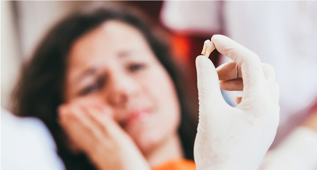 dental extractions