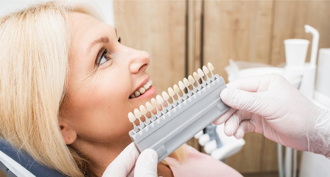 veneers