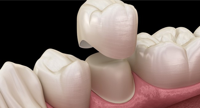 general dentistry