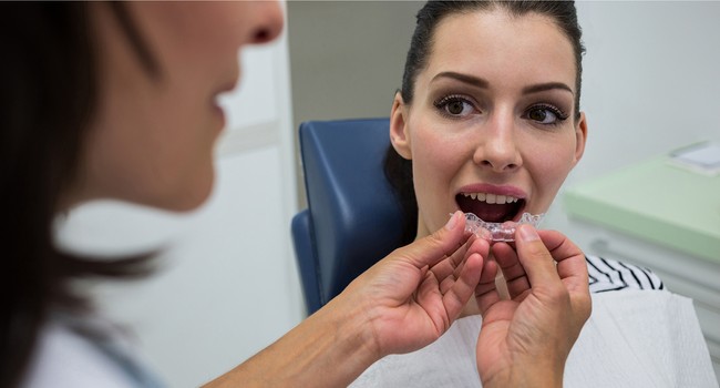 invisalign