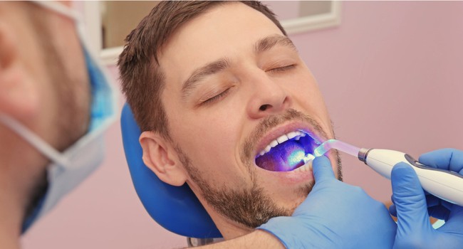 cosmetic fillings
