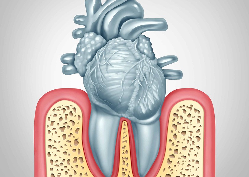 blog cover