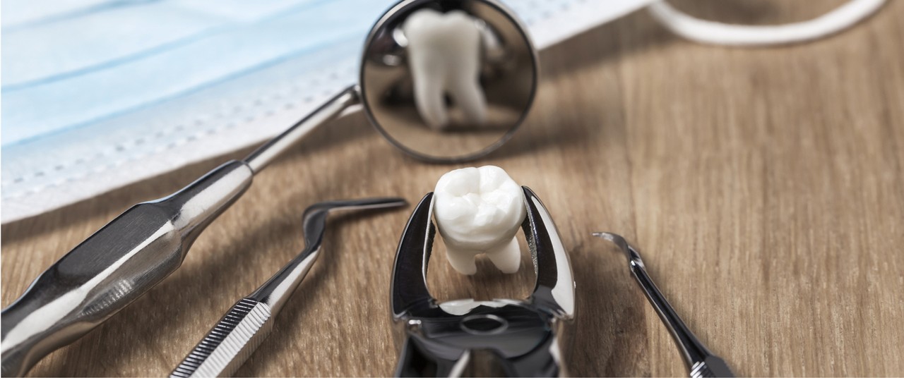 dental extractions