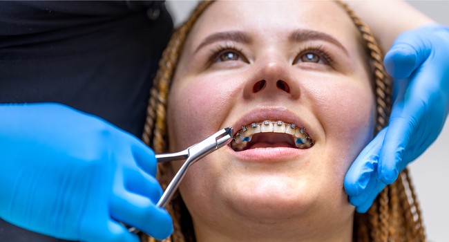 orthodontics